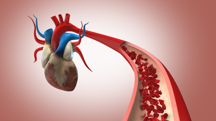 A realistic 3D illustrated heart has a major artery projecting into the foreground with a cutaway view showing red blood cells