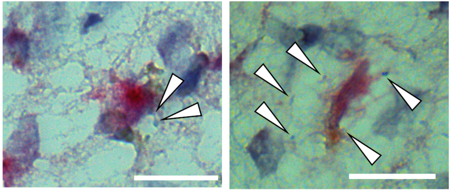 Microscope images show astrocyte cells with magenta staining. Small blue dots are visible around some of the astrocyte cells and those dots are indicated by large white arrows.