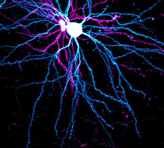 Microscopic image of neurons in different colors, against a black background.