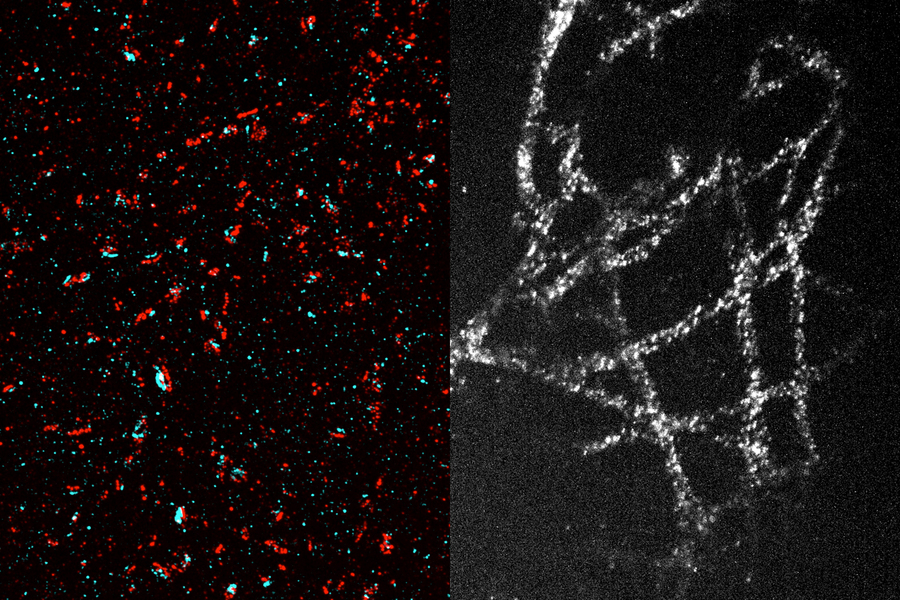 A new method makes high-resolution imaging more accessible | MIT 