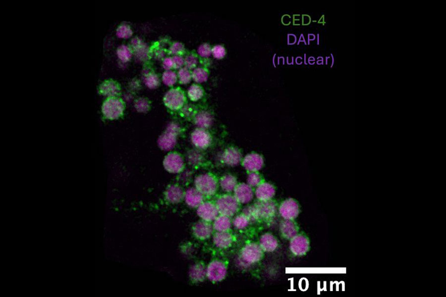 Nematode embryos appear as green and purple circles on a dark background
