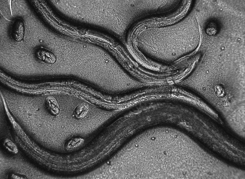 Grayscale image of nematode worms under a microscope