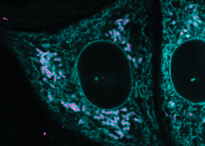 Photomicrograph of a cell whose organelles are lit up to highlight Rickettsia (magenta) infecting and interacting with the ER (cyan)