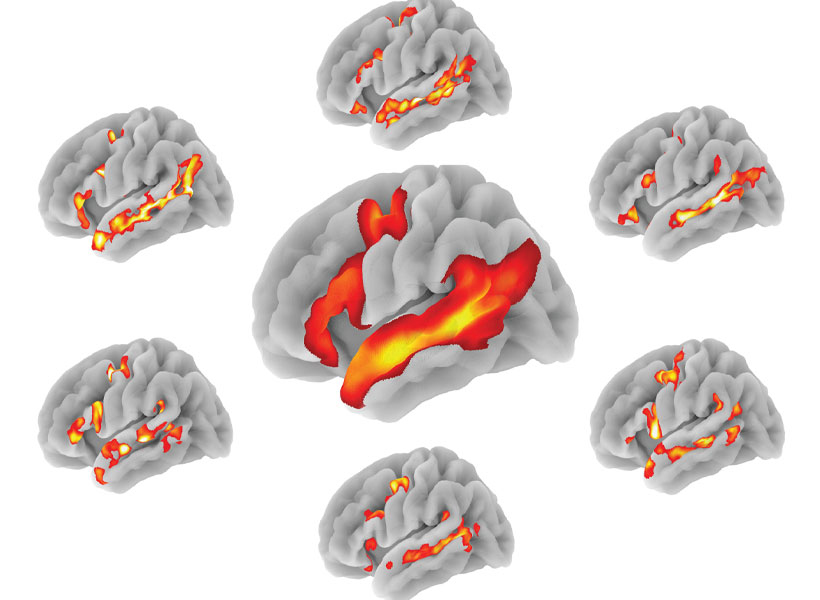 Six small fMRI brain scans surround one larger one, all showing different regions highlighted in red.