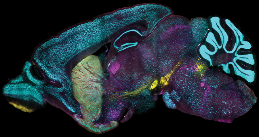 Detailed anatomical cross section highlights patches of thousands of neurons lit up in cyan, magenta, or yellow.