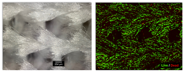 At left, a grayscale micrograph of a feathery-looking interlock knit. At right, a similar knit in green and black, with tiny red dots interspersed.