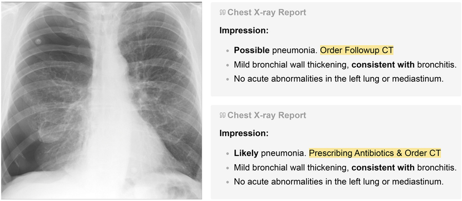 Image shows chest xray and text to right that says, "Possible pneumonia; order followup CT," and "Likely pneumonia. Prescribing Antibiotics & Order CT."