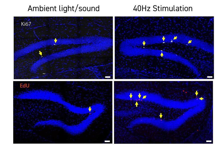 2 by 2 grid of panels that each show a hairpin-like shape of blue stained cells. Left column is labeled "Ambient light/sound." Right column is labeled "40Hz Stimulation." Panels in the 40Hz column show more arrows pointing to white blotches than the panels in the ambient column.