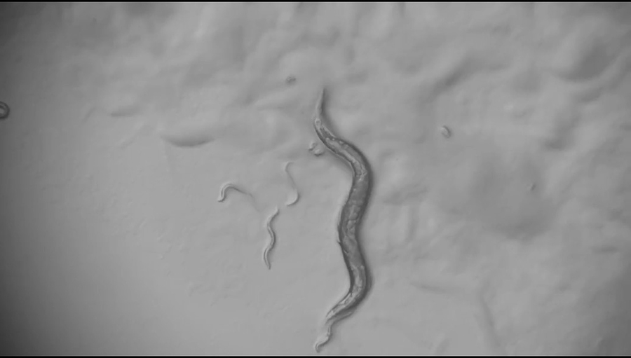 A grayscale photomicrograph of a squiggly worm against a lumpy background