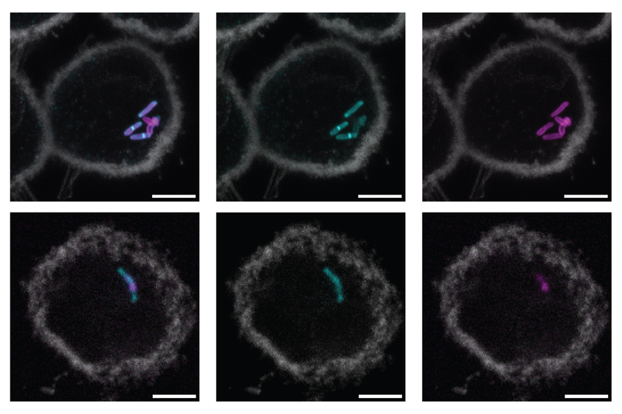 Tuberculosis bacteria