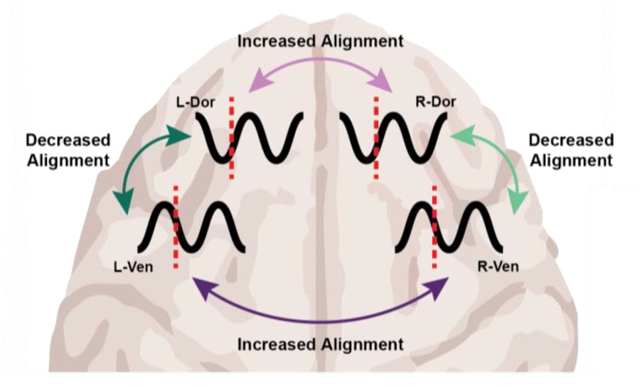 A cartoon of the front of the brain is labeled by its left and right hemispheres and the top and bottom region of each. Each quadrant has a brain wave. The waves are shown as misaligned within a hemisphere but more aligned across hemispheres.