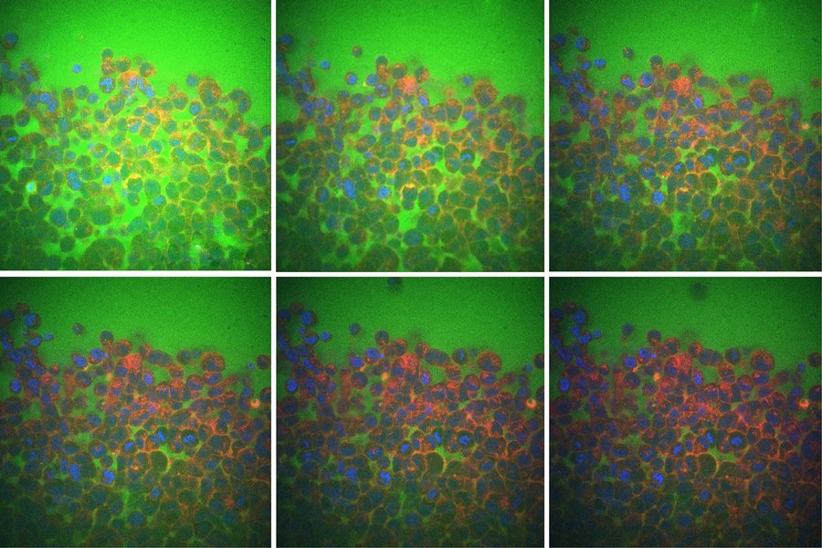 MITのエンジニアが、組織が柔軟であったり硬かったりする意外な理由を解明(MIT engineers uncover a surprising reason why tissues are flexible or rigid)