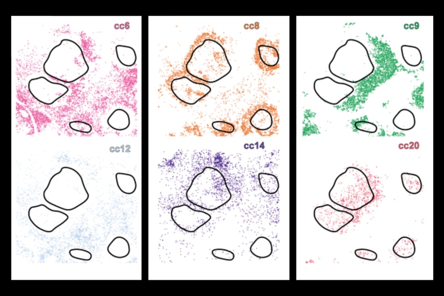 Grid of 6 microscopic views of small cells around larger tumors. Each view highlights different cell subpopulations colored in a different color.