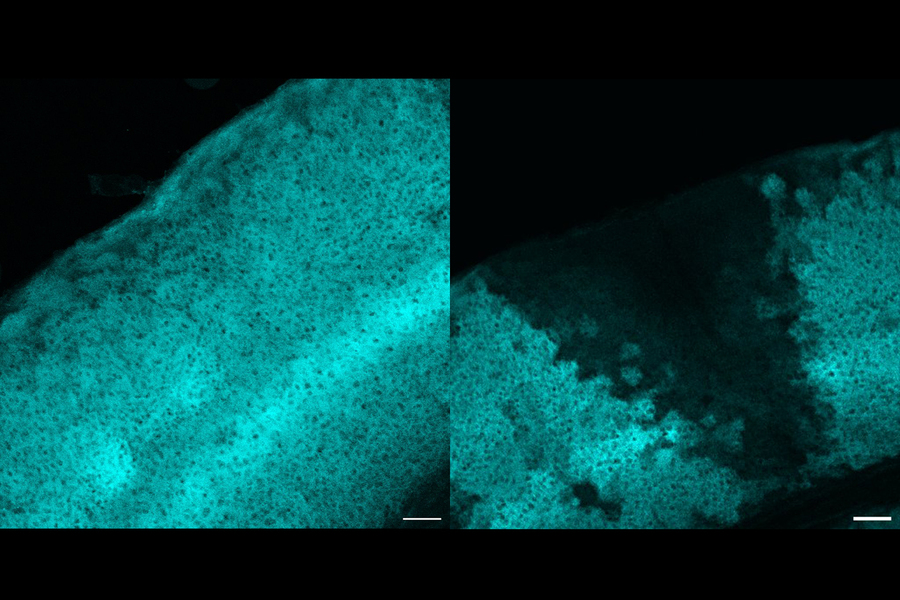Two square micrographs show an arc of densely-packed brain tissue. Lefthand image shows a continuous arc, but the righthand image features a wedge where the cyan staining is absent.