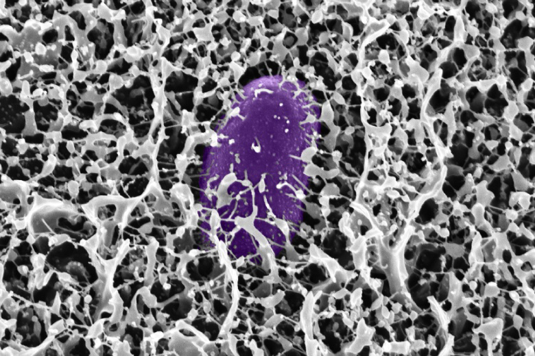 Bacteria surrounds salmonella, centered and in purple.