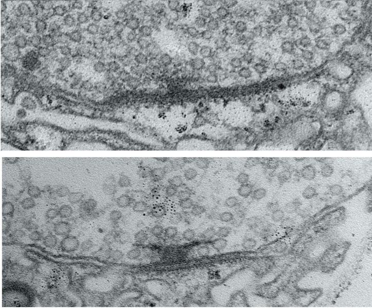 Two stacked electron microscope images show a synapse. A dark T shape features among many tiny bubble-like circles. In the bottom image the T shape is much bigger than in the upper image.