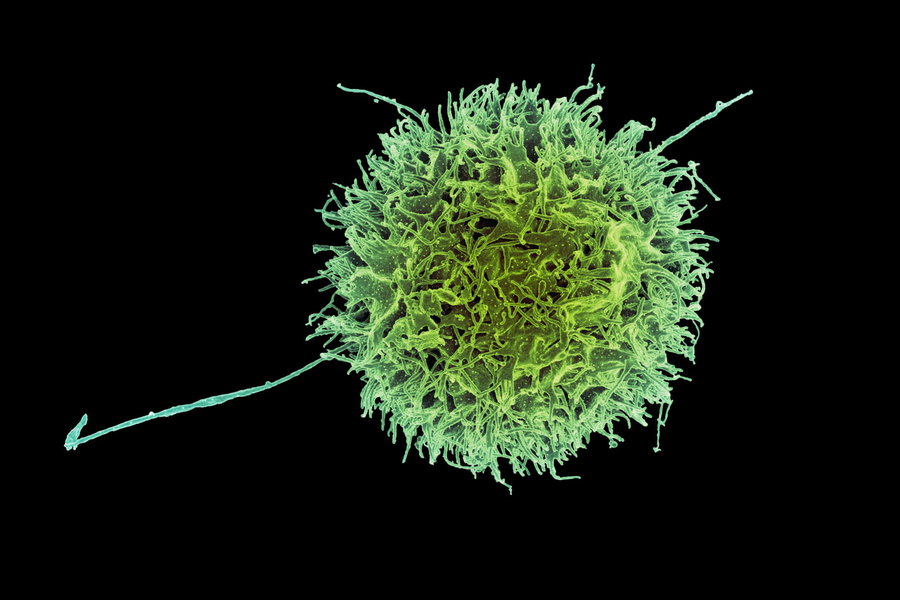 Engineered “natural killer” cells could help fight cancer | MIT