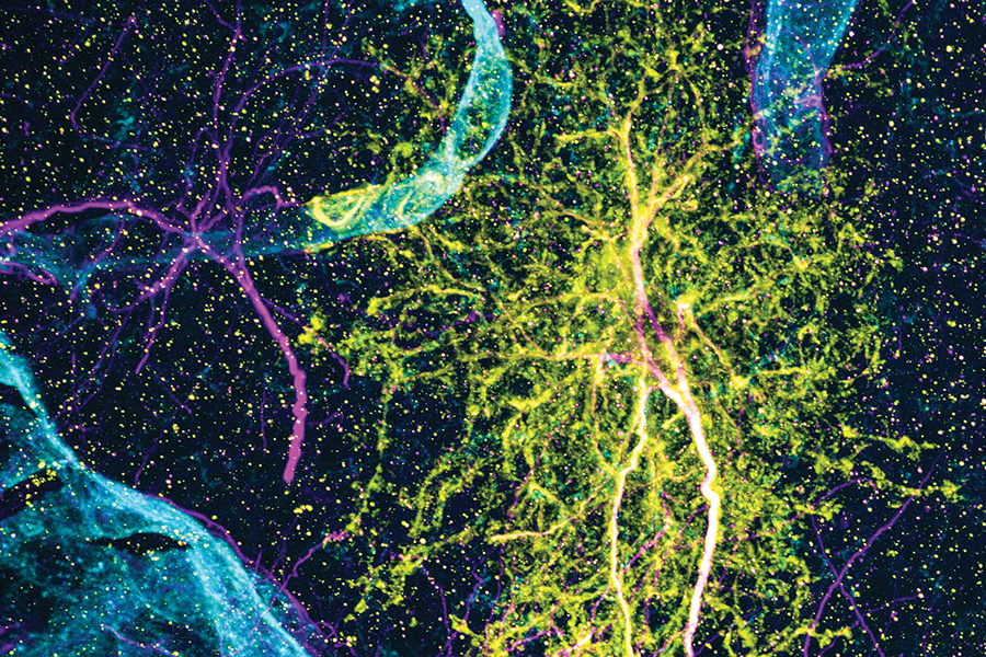 Microscope image of a star-shaped yellow neuron.