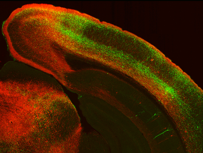 A cross section of neurons shows cells stained in red and green along an arc of tissue that extends from the upper left of the image to the bottom right.