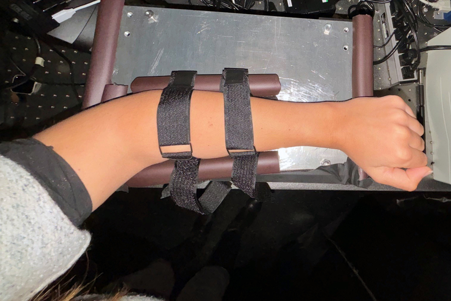 A person wearing the glucose monitor on their forearm