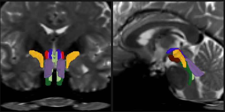 In two panels there are face-on and side-view cross sections of a human brain in pixellated gray. In the bottom center of each image color-coded crescent shapes delineate discrete nerve fiber bundles.