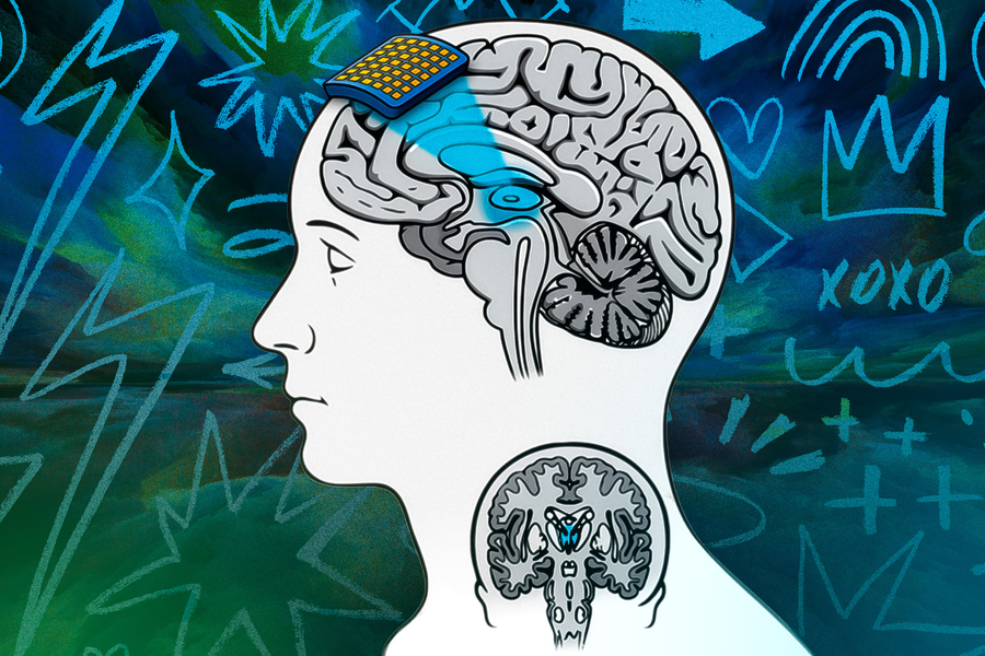 A grid-like patch sits on top of a human head. It sends blue light to a tiny part of the brain.