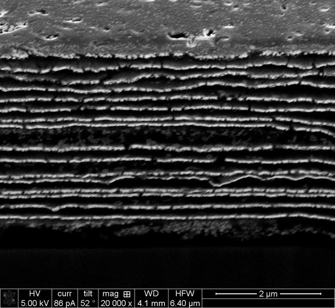 A photomicrograph shows the 