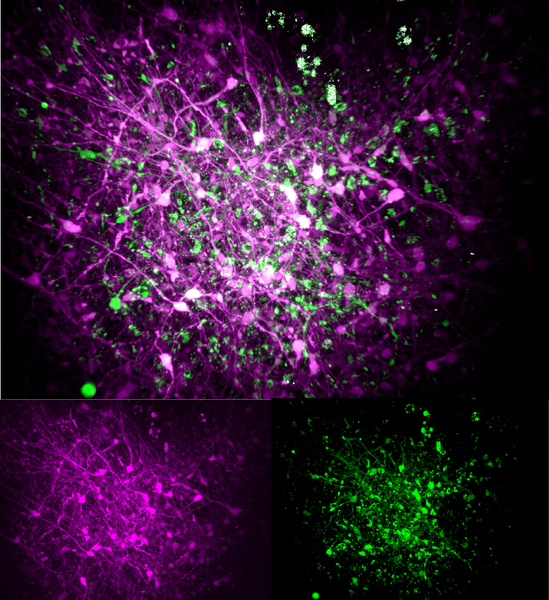 Three panels show differently colored views of a roundish array of brain cells. The top features cells in magenta, green and white. Bottom left is magenta. Bottom right is green.