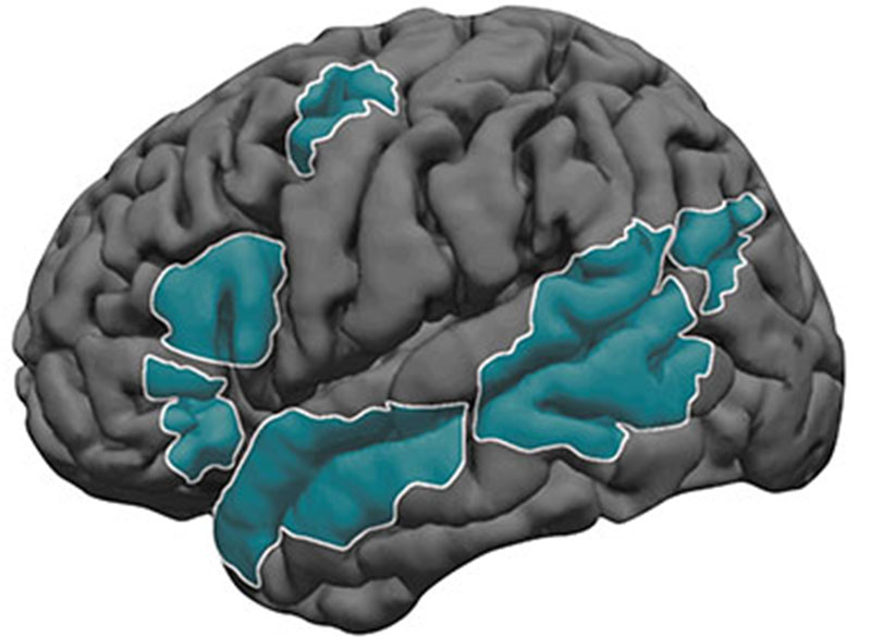 A grayscale illustration of the human brain with various regions highlighted in teal