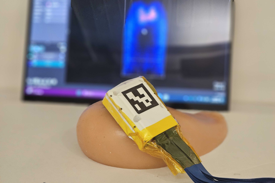 The device prototype rests on a breast prosthetic.