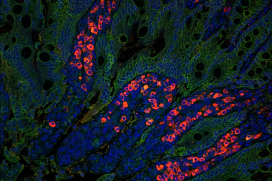 Intestinal cells show red spots in microscopic view