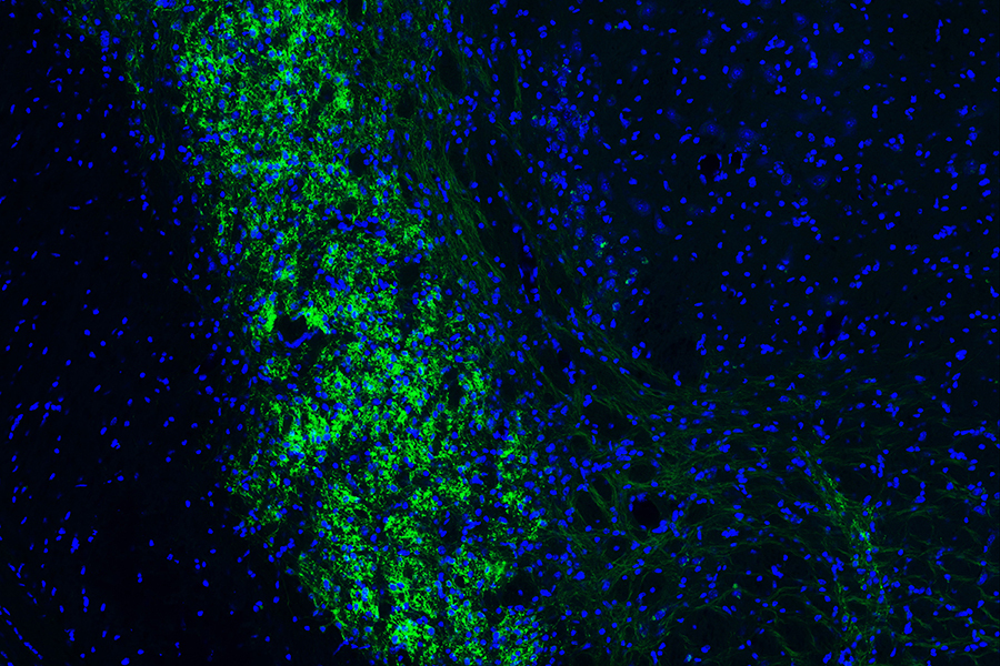 Bright green cells form a column against dark blue background cells as seen under a microscope