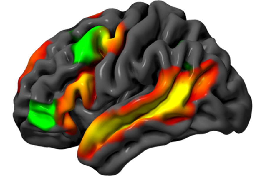 A 3D model of the human brain in grey, with different regions highlighted in red, green, and yellow.