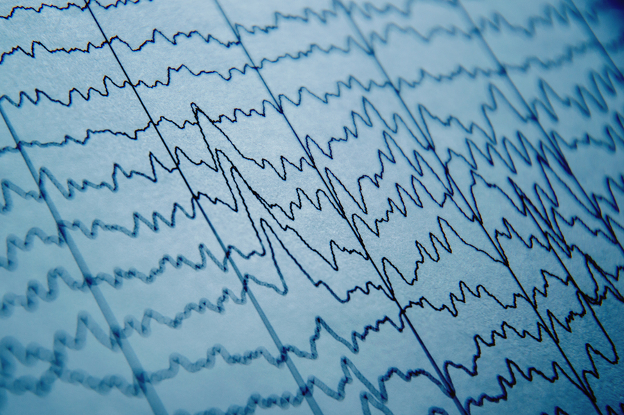 Closeup up paper displaying dark blue traces of many squiggly brain waves as they run across the page