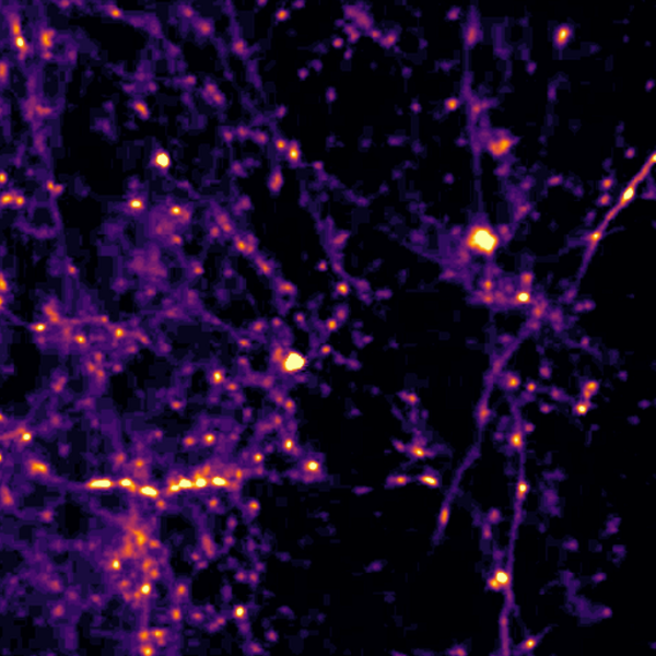 Over a tangle of dark blue neurons, bright orange spots appear along the lengths of some of the axons