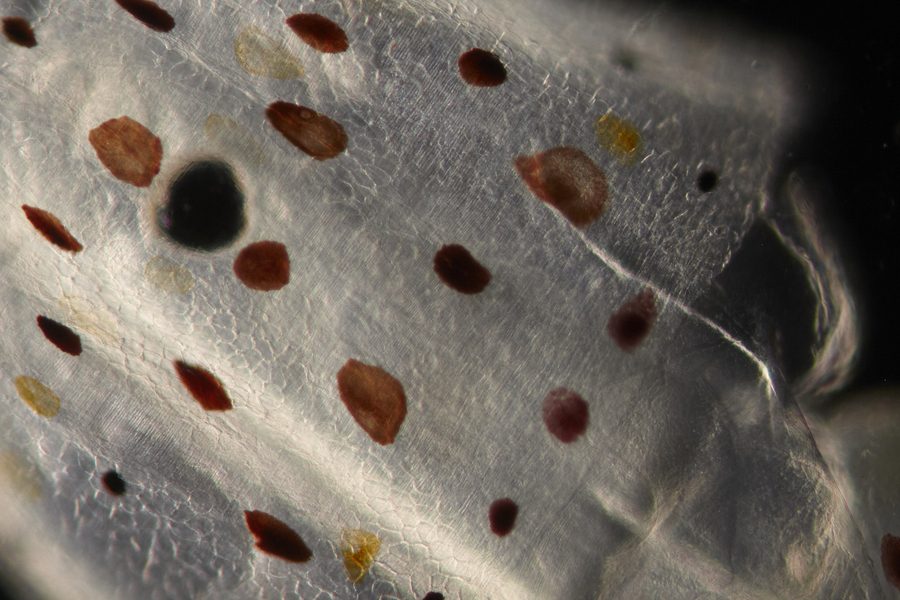 A close-up view of translucent skin with spots in various shades of brown
