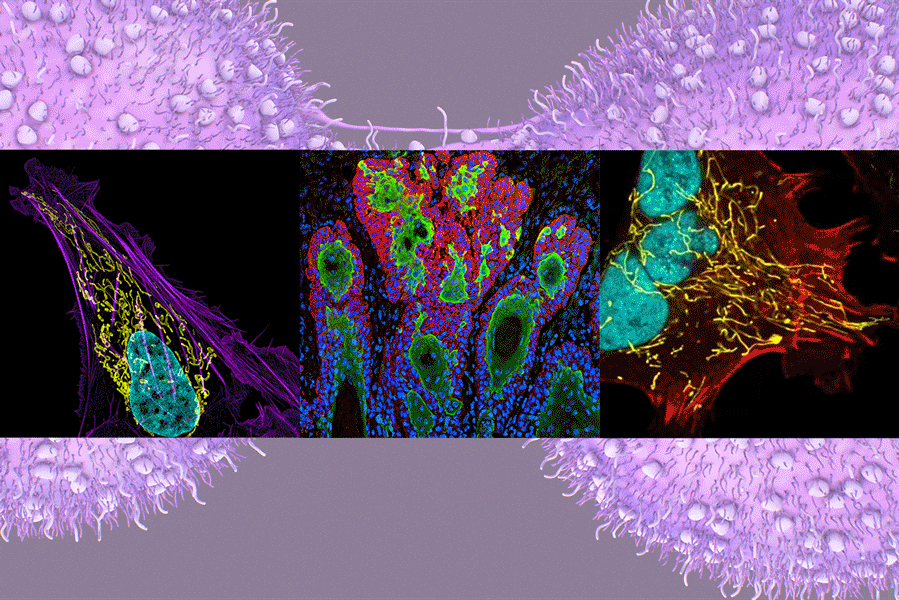 Three screens of colorful cancer cells