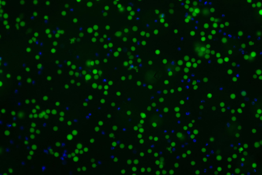 Green dots and smaller blue dots