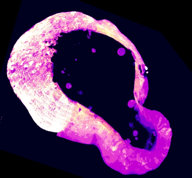 Micrograph of an organic-looking purple-and-white irregular loop