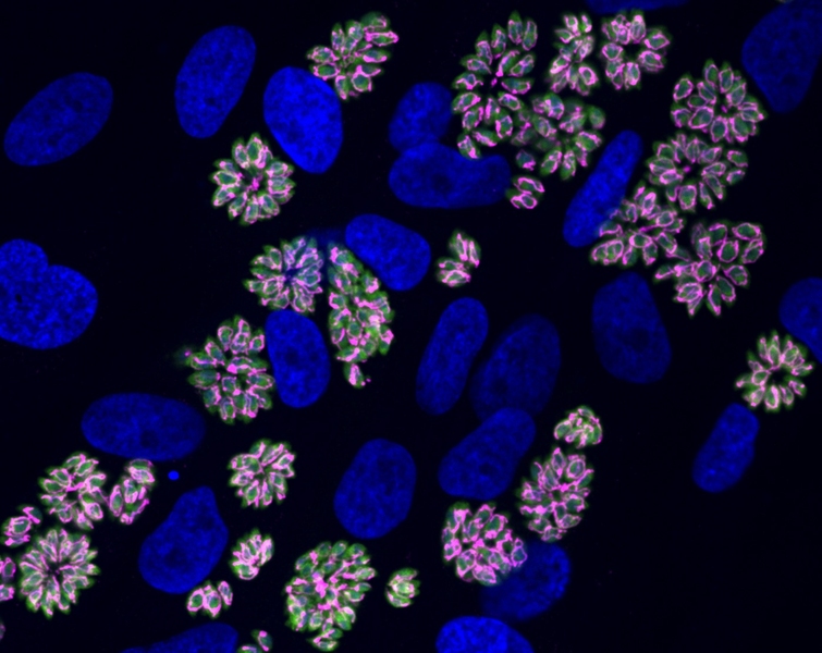 Micrograph: Clusters of parasites (like rings of oval beads) near large blue organelles