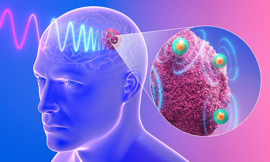 3D illustration of a translucent blue human head in profile with a visible brain; electromagnetic waves target a tumor site near the skull, while a circular inset magnifies green-and-orange nanoparticles emitting energy waves within pink tumor tissue.