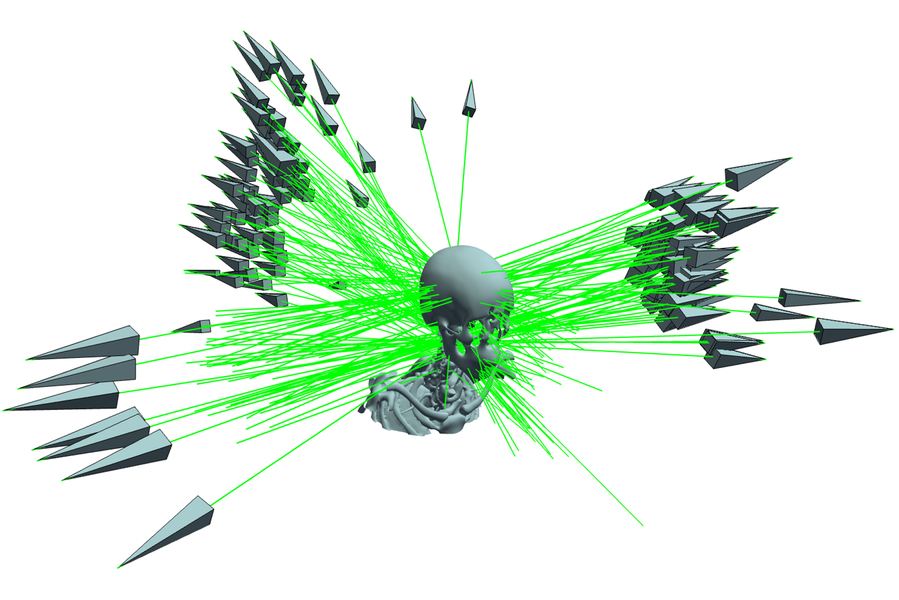 Dozens of lasers fly through a 3D skull from all angles.
