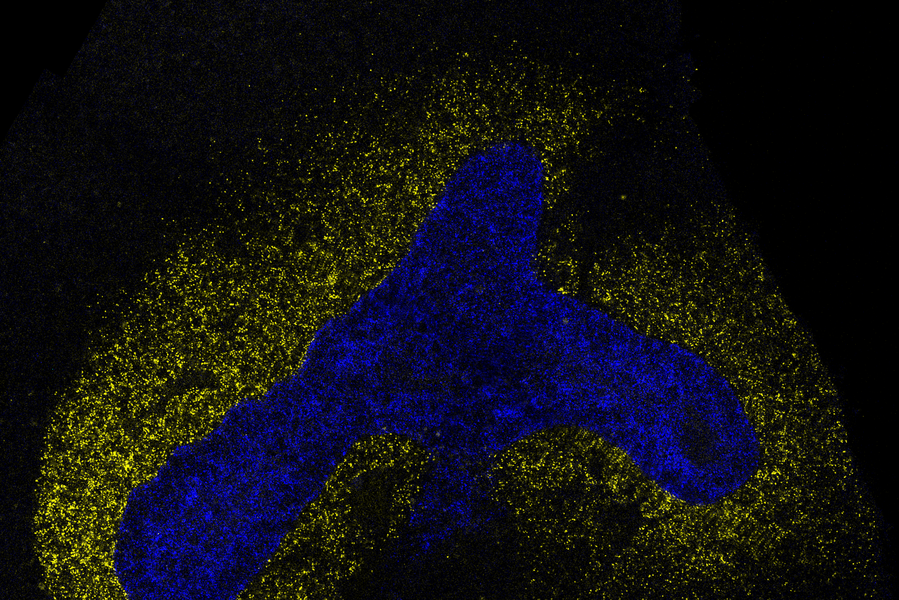 Microscopic image of cells stained blue in a boomerang-like shape, surrounded by cells stained yellow, all on a black background