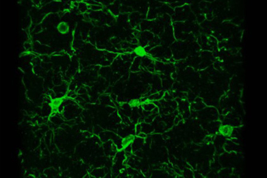 Image of brain cells, appearing green on a black background