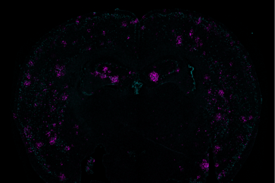 On a black background in the curvy M-like shape of a mouse brain cross section, many patches of tiny teal and purple dots appear