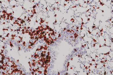 feature article about covid 19 pandemic On a grey background sits brown and purple particles with red circles around the brown spots.