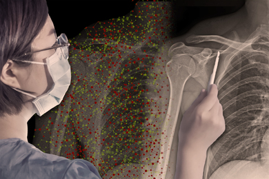 Medical technician looking at an X-ray with the help of an AI assistant