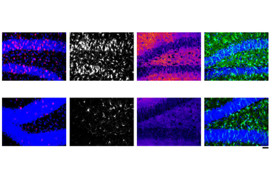 Two rows of four images show mouse brain tissue stained in various colors to denote the presence of certain molecules. There is much more colorful staining in the top row than in the bottom.