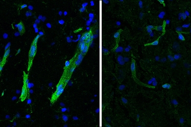 Two panels show diagonal streaks of green-stained brain blood vessels over a background of blue cells. The green staining is much brighter in the left panel than in the right.