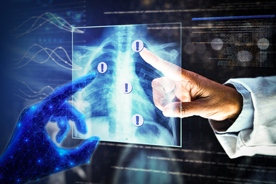 Two hands inspect a lung X-ray. One hand is illustrated with nodes and lines creating a neural network. The other is a doctor’s hand. Four “alert” icons appear on the lung X-ray.